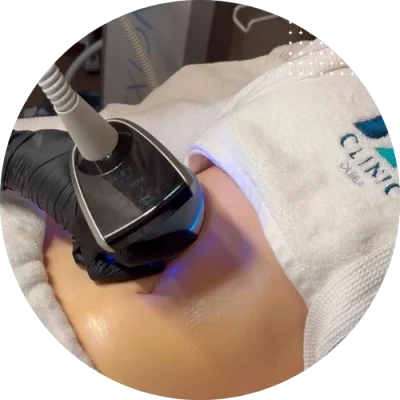 non-surgical-img-1